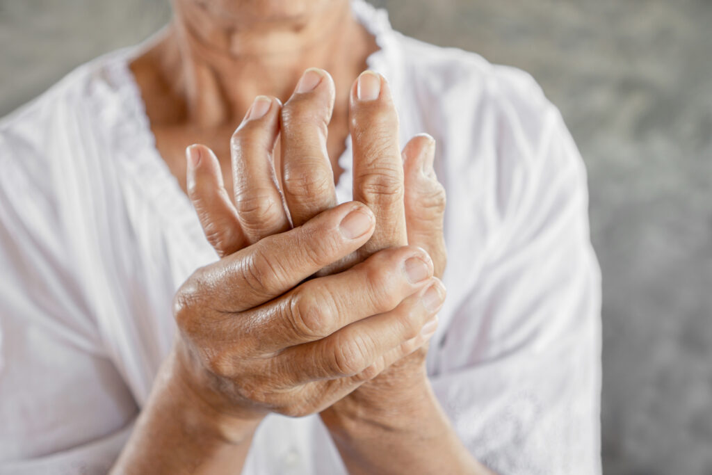 Arthritis Treatment